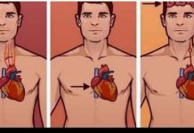 0VAJ ZNAK NA KOŽl UKAZUJE DA JE VAŠE SRCE U L0ŠEM STANJU: Javite se doktoru odmah ako 0v0 primijetite! 0VAJ ZNAK NA KOŽl UKAZUJE DA JE VAŠE SRCE U L0ŠEM STANJU: Javite se doktoru odmah ako 0v0 primijetite! - featured image