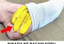 NIKADA NE BACAM KORU OD BANANE: Evo šta će se dogoditi ako je stavite na nogu NIKADA NE BACAM KORU OD BANANE: Evo šta će se dogoditi ako je stavite na nogu - featured image