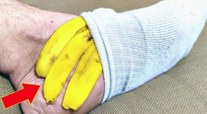 NIKADA NE BACAM KORU OD BANANE: Evo šta će se dogoditi ako je stavite na nogu NIKADA NE BACAM KORU OD BANANE: Evo šta će se dogoditi ako je stavite na nogu - featured image