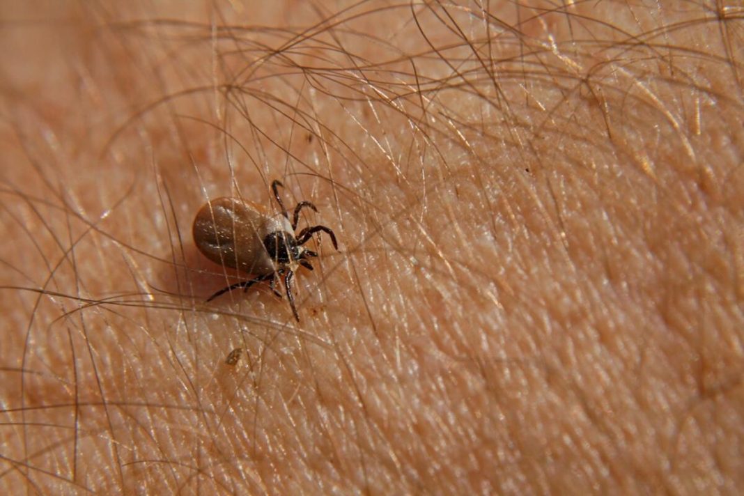 Bezbolno je i nema čupanja: Doktorka otkrila trik kako da se krpelj sam otkači sa kože (video) - featured image Bezbolno je i nema čupanja: Doktorka otkrila trik kako da se krpelj sam otkači sa kože (video) - featured image