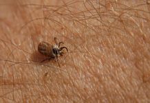 Bezbolno je i nema čupanja: Doktorka otkrila trik kako da se krpelj sam otkači sa kože (video) Bezbolno je i nema čupanja: Doktorka otkrila trik kako da se krpelj sam otkači sa kože (video) - featured image
