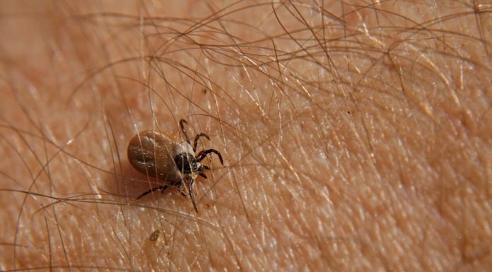 Bezbolno je i nema čupanja: Doktorka otkrila trik kako da se krpelj sam otkači sa kože (video) Bezbolno je i nema čupanja: Doktorka otkrila trik kako da se krpelj sam otkači sa kože (video) - featured image