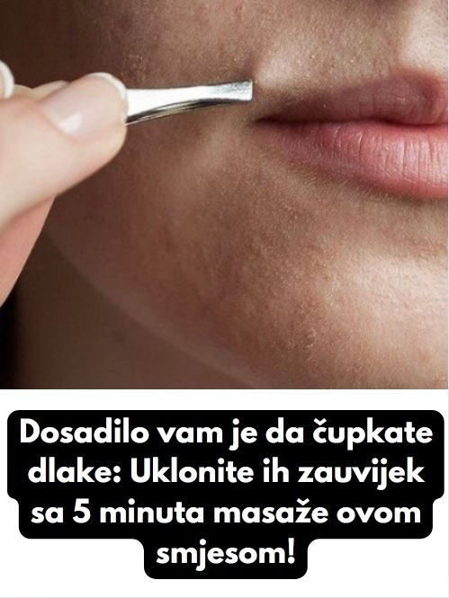 Dosadilo vam je da čupkate dlake: Uklonite ih zauvijek sa 5 minuta masaže ovom smjesom! - featured image Dosadilo vam je da čupkate dlake: Uklonite ih zauvijek sa 5 minuta masaže ovom smjesom! - featured image