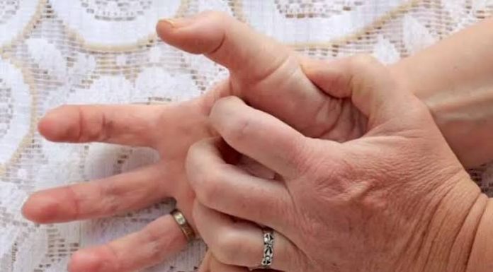 ŠTA ZNAČI KAD VAS SVRBI LIJEVI ILI DESNI DLAN: Sljedeći put ćete makar znati ŠTA VAS ČEKA! ŠTA ZNAČI KAD VAS SVRBI LIJEVI ILI DESNI DLAN: Sljedeći put ćete makar znati ŠTA VAS ČEKA! - featured image